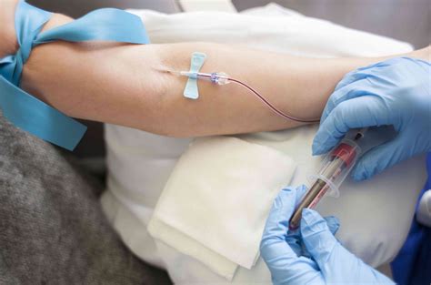 venous blood gas sample